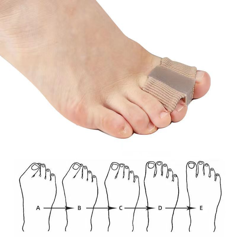 Fiber toe separator